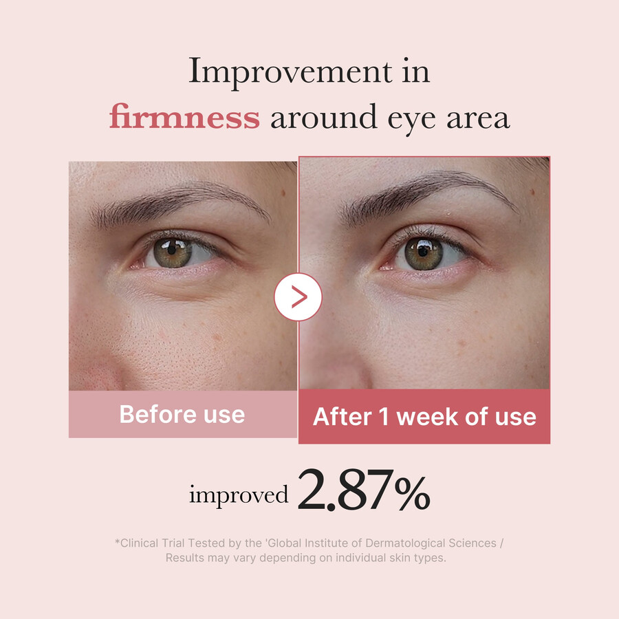 creme para os olhos medicube pdrn pink peptide