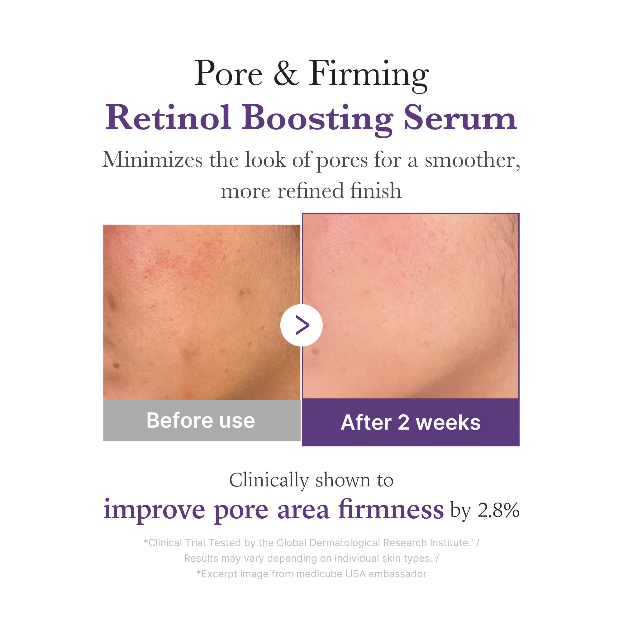soro potenciador de retinol nmn