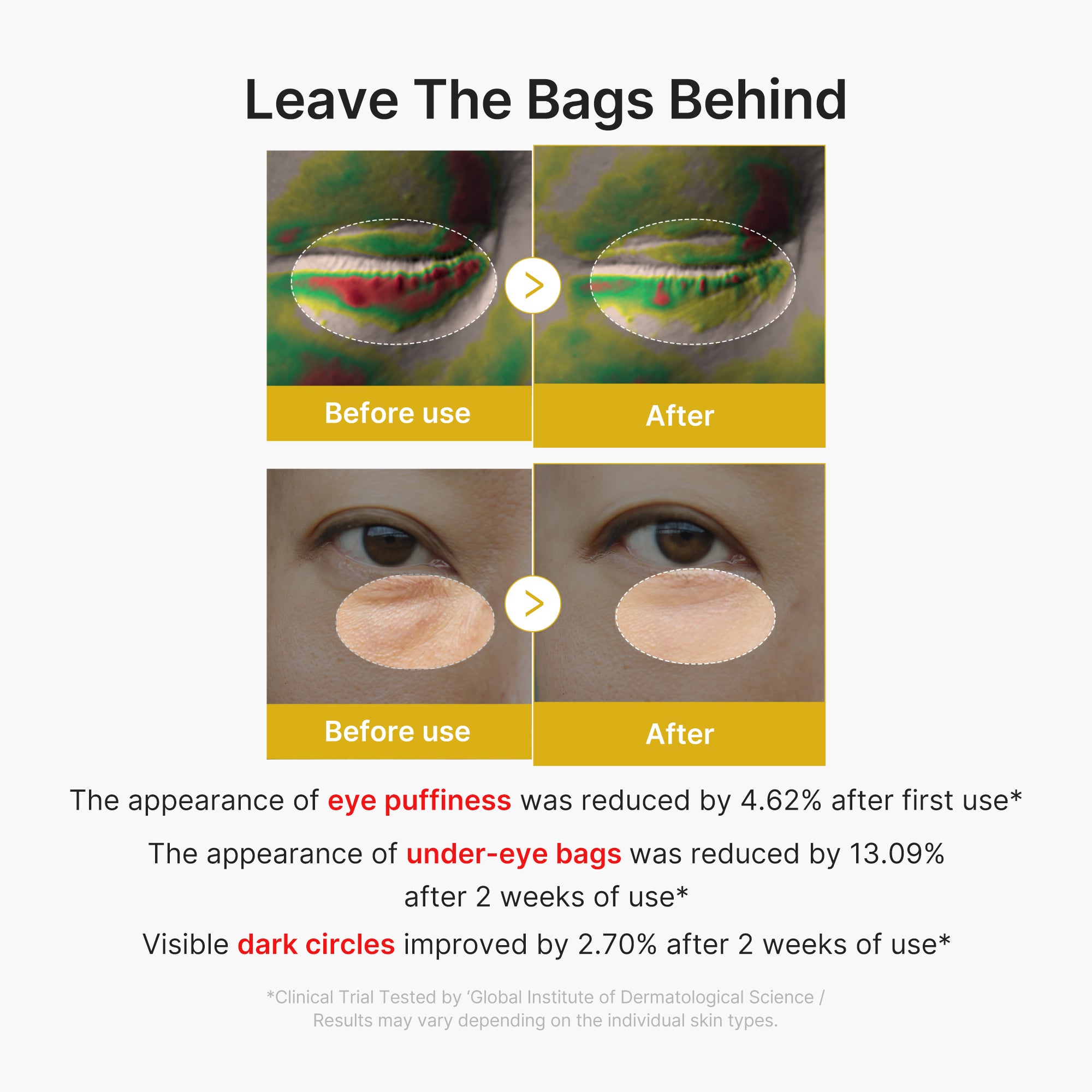 soro em gel para olhos com ácido kójico e cúrcuma