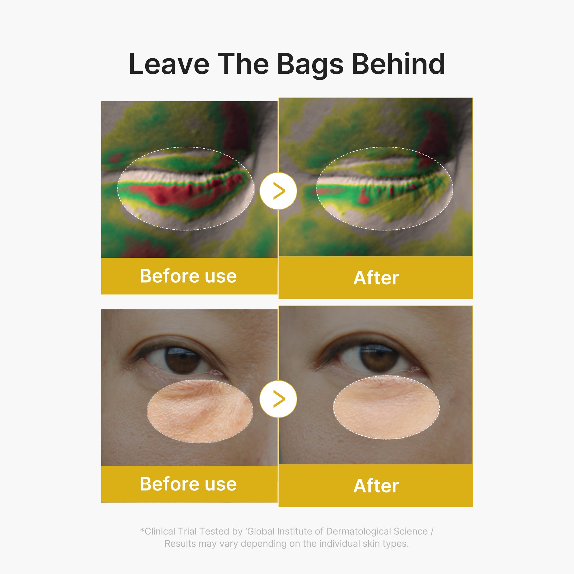 soro em gel para olhos com ácido kójico e cúrcuma