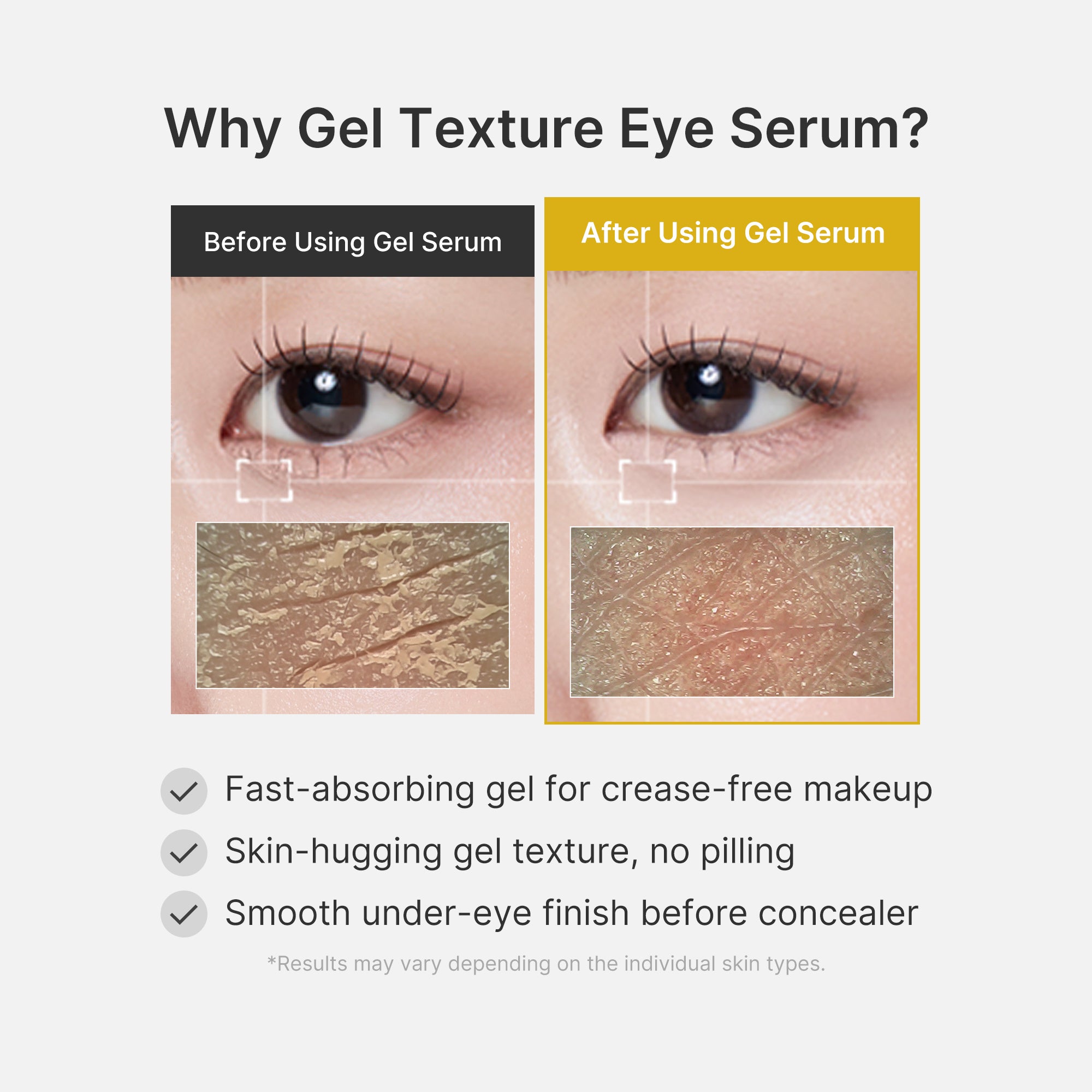soro em gel para olhos com ácido kójico e cúrcuma